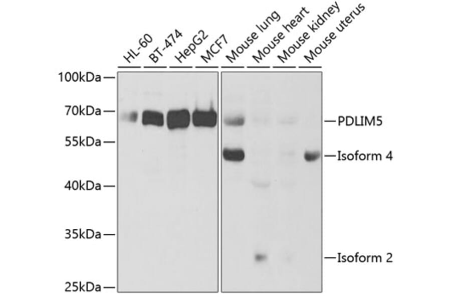Western Blot - Anti-PDLIM5 / ENH Antibody (A14933) - Antibodies.com