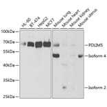 Western Blot - Anti-PDLIM5 / ENH Antibody (A14933) - Antibodies.com