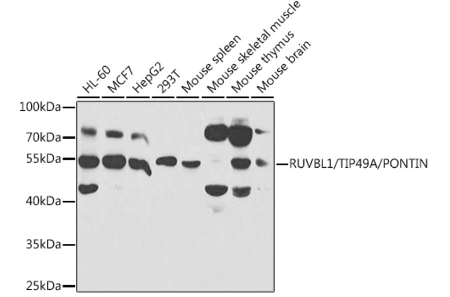 Western Blot - Anti-TIP49A Antibody (A14934) - Antibodies.com