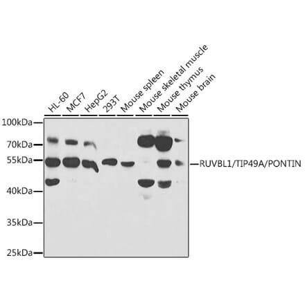 Western Blot - Anti-TIP49A Antibody (A14934) - Antibodies.com