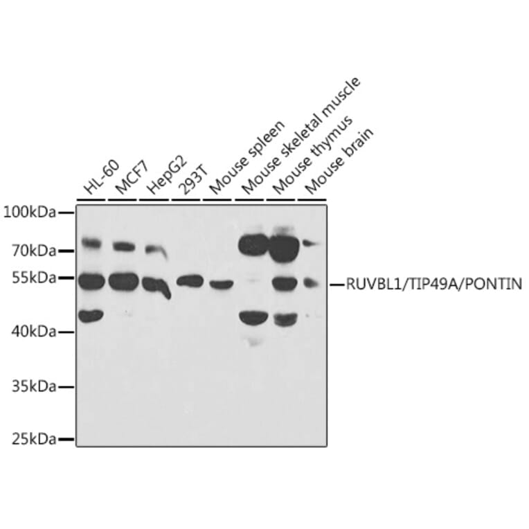 Western Blot - Anti-TIP49A Antibody (A14934) - Antibodies.com