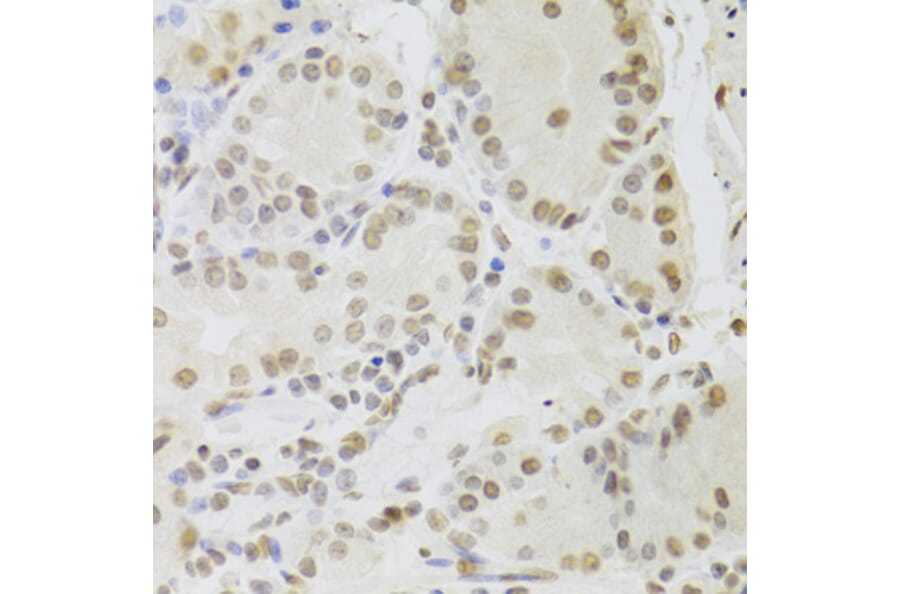 Immunohistochemistry - Anti-TIP49A Antibody (A14934) - Antibodies.com