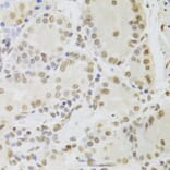 Immunohistochemistry - Anti-TIP49A Antibody (A14934) - Antibodies.com