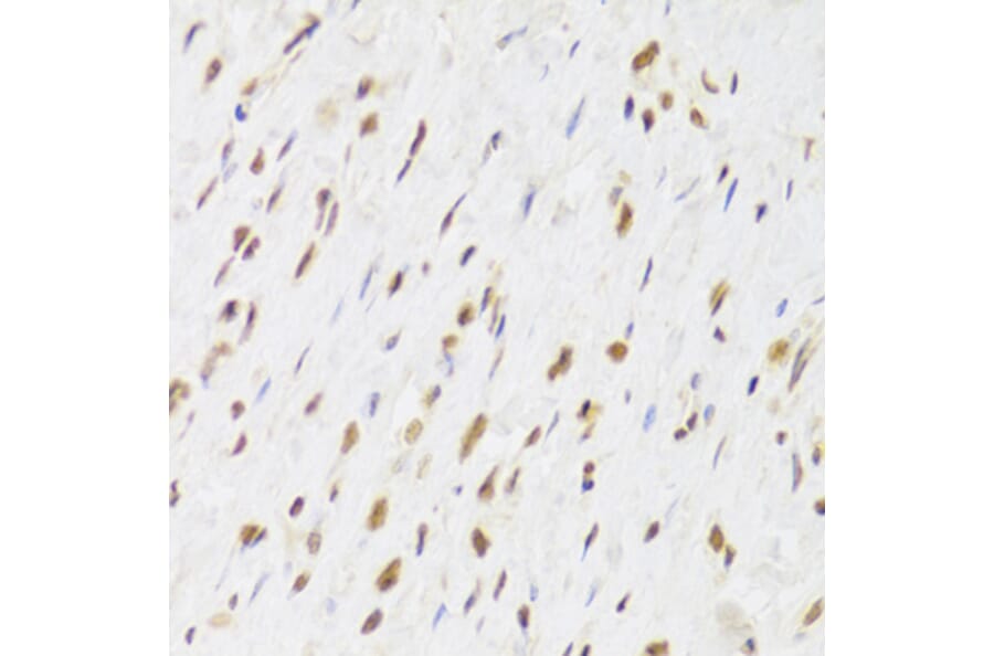 Immunohistochemistry - Anti-TIP49A Antibody (A14934) - Antibodies.com