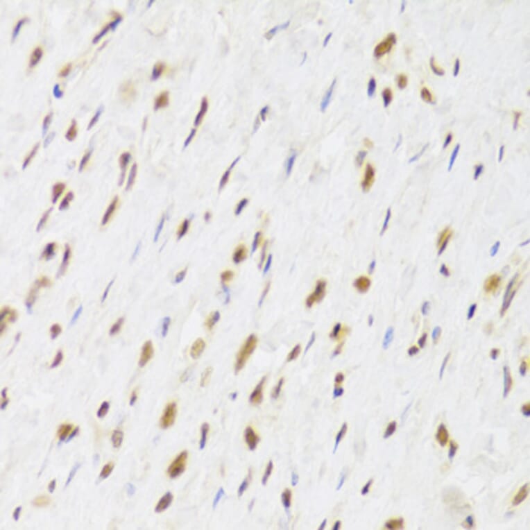 Immunohistochemistry - Anti-TIP49A Antibody (A14934) - Antibodies.com
