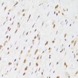 Immunohistochemistry - Anti-TIP49A Antibody (A14934) - Antibodies.com
