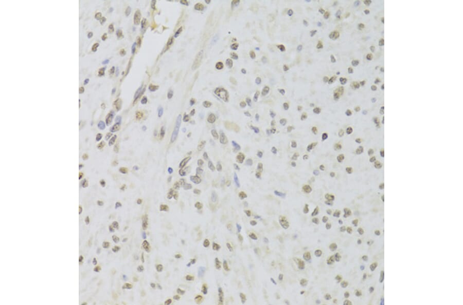 Immunohistochemistry - Anti-TIP49A Antibody (A14934) - Antibodies.com
