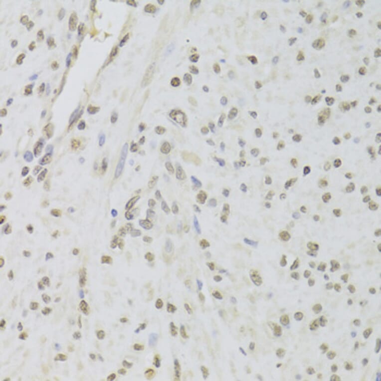 Immunohistochemistry - Anti-TIP49A Antibody (A14934) - Antibodies.com