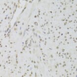 Immunohistochemistry - Anti-TIP49A Antibody (A14934) - Antibodies.com