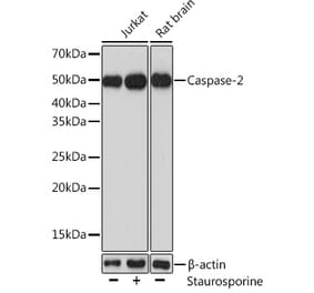 Western Blot - Anti-Caspase-2 Antibody (A14935) - Antibodies.com