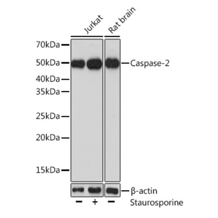 Western Blot - Anti-Caspase-2 Antibody (A14935) - Antibodies.com