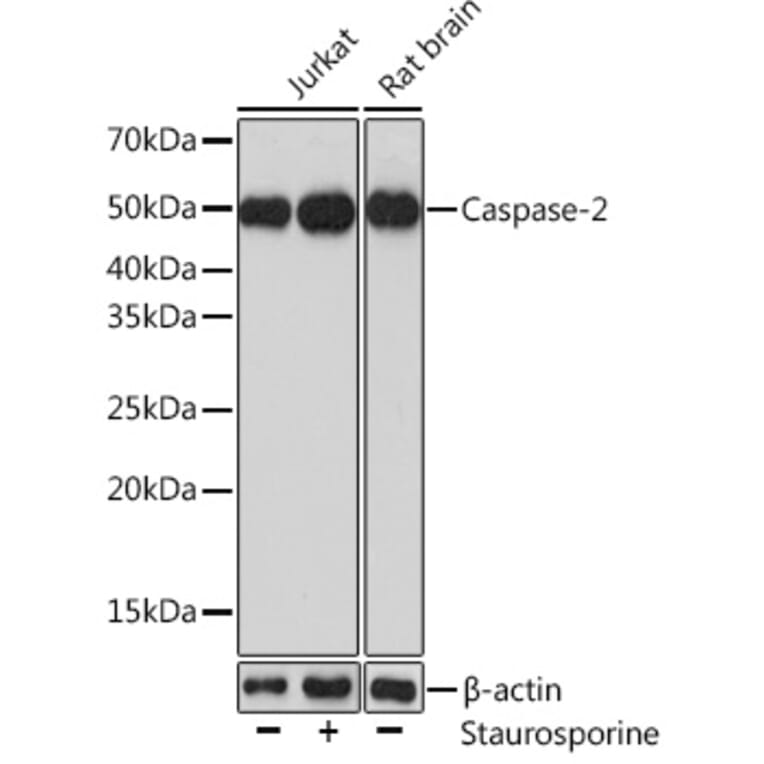 Western Blot - Anti-Caspase-2 Antibody (A14935) - Antibodies.com