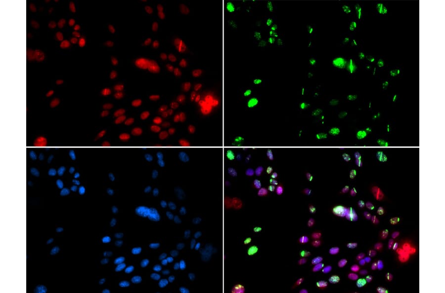 Immunofluorescence - Anti-PIAS1 Antibody (A14936) - Antibodies.com