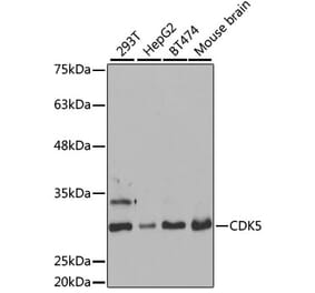 Western Blot - Anti-CDK5 Antibody (A14937) - Antibodies.com