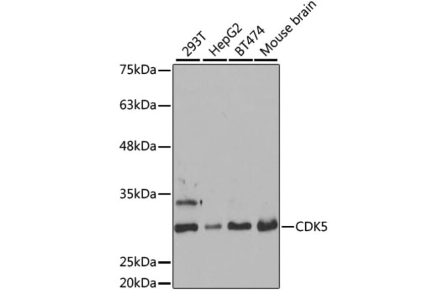 Western Blot - Anti-CDK5 Antibody (A14937) - Antibodies.com
