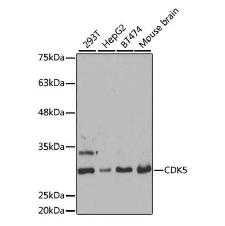 Western Blot - Anti-CDK5 Antibody (A14937) - Antibodies.com