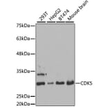 Western Blot - Anti-CDK5 Antibody (A14937) - Antibodies.com