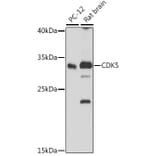 Western Blot - Anti-CDK5 Antibody (A14937) - Antibodies.com