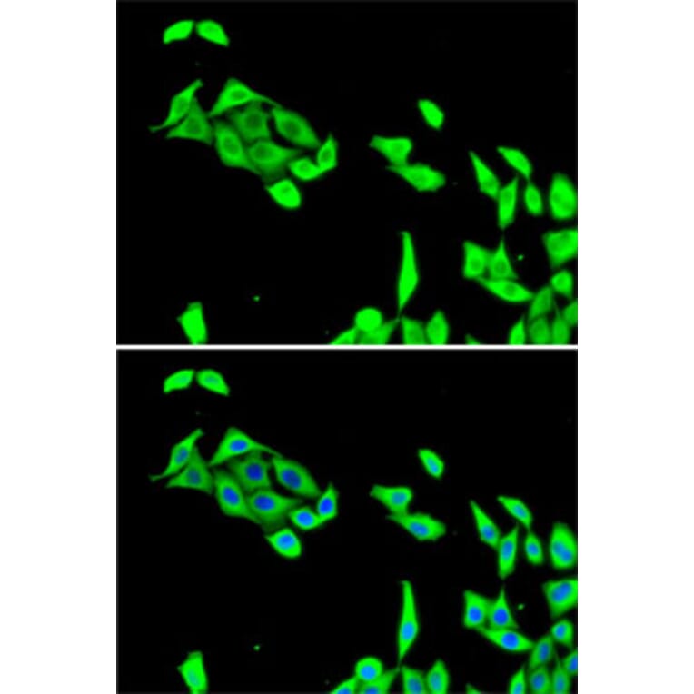 Immunofluorescence - Anti-CDK5 Antibody (A14937) - Antibodies.com