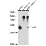 Western Blot - Anti-CDK5 Antibody (A14937) - Antibodies.com