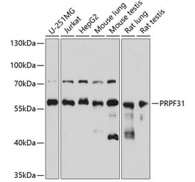 Western Blot - Anti-PRPF31 Antibody (A14938) - Antibodies.com