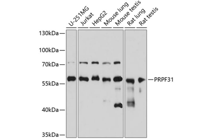 Western Blot - Anti-PRPF31 Antibody (A14938) - Antibodies.com