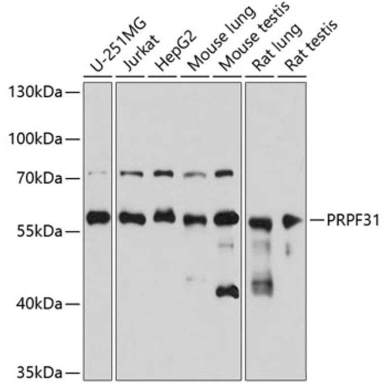Western Blot - Anti-PRPF31 Antibody (A14938) - Antibodies.com