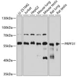Western Blot - Anti-PRPF31 Antibody (A14938) - Antibodies.com