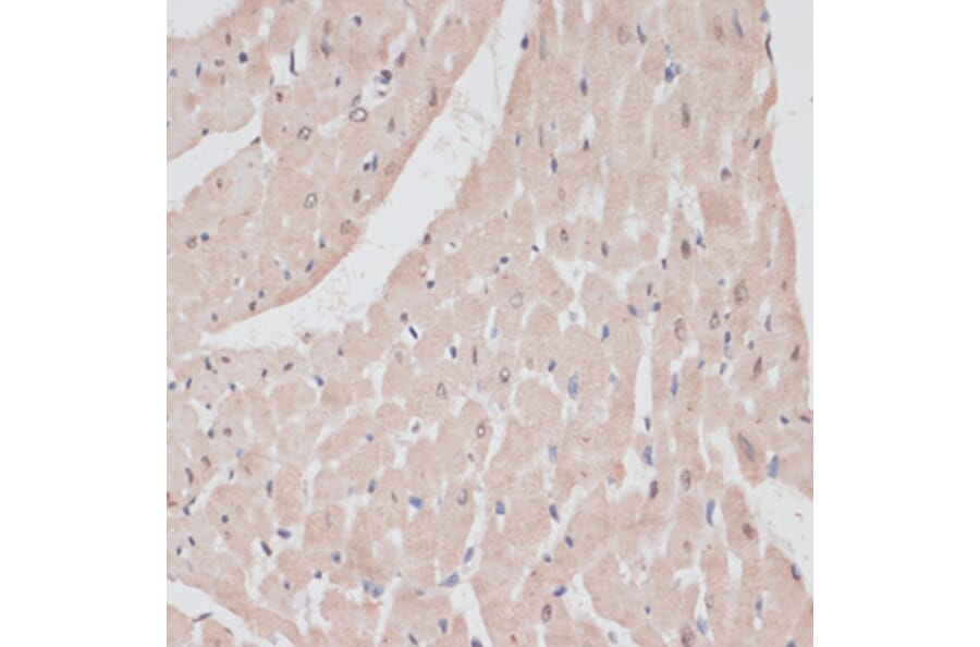 Immunohistochemistry - Anti-PRPF31 Antibody (A14938) - Antibodies.com