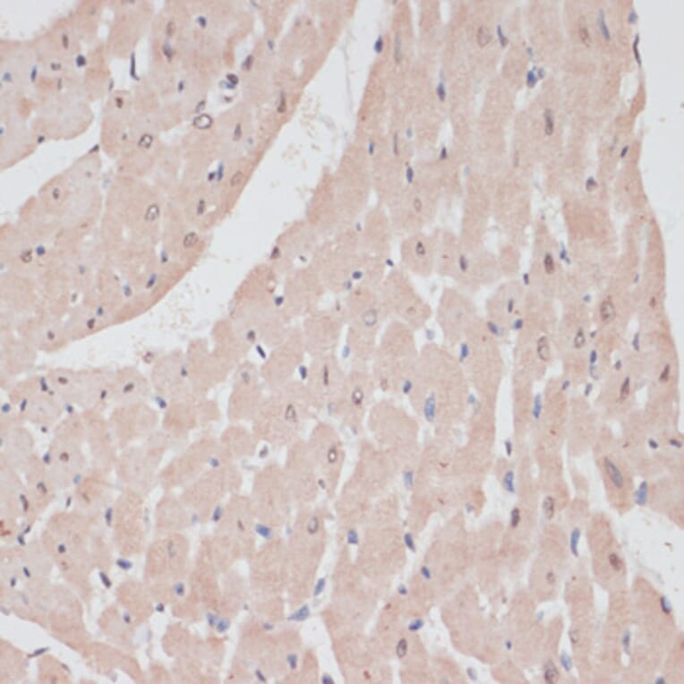 Immunohistochemistry - Anti-PRPF31 Antibody (A14938) - Antibodies.com