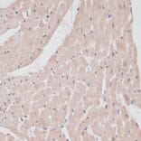 Immunohistochemistry - Anti-PRPF31 Antibody (A14938) - Antibodies.com