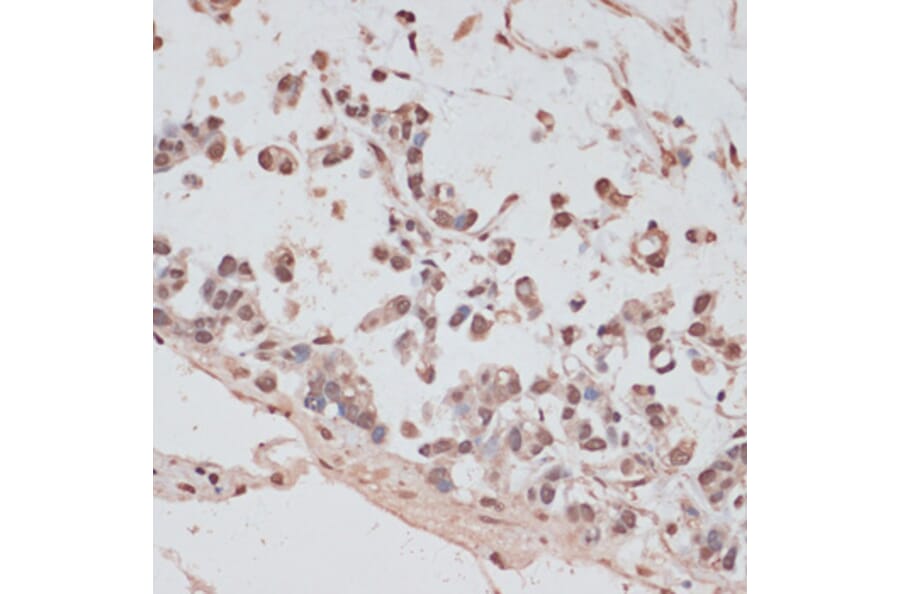 Immunohistochemistry - Anti-PRPF31 Antibody (A14938) - Antibodies.com