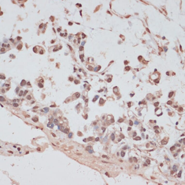 Immunohistochemistry - Anti-PRPF31 Antibody (A14938) - Antibodies.com