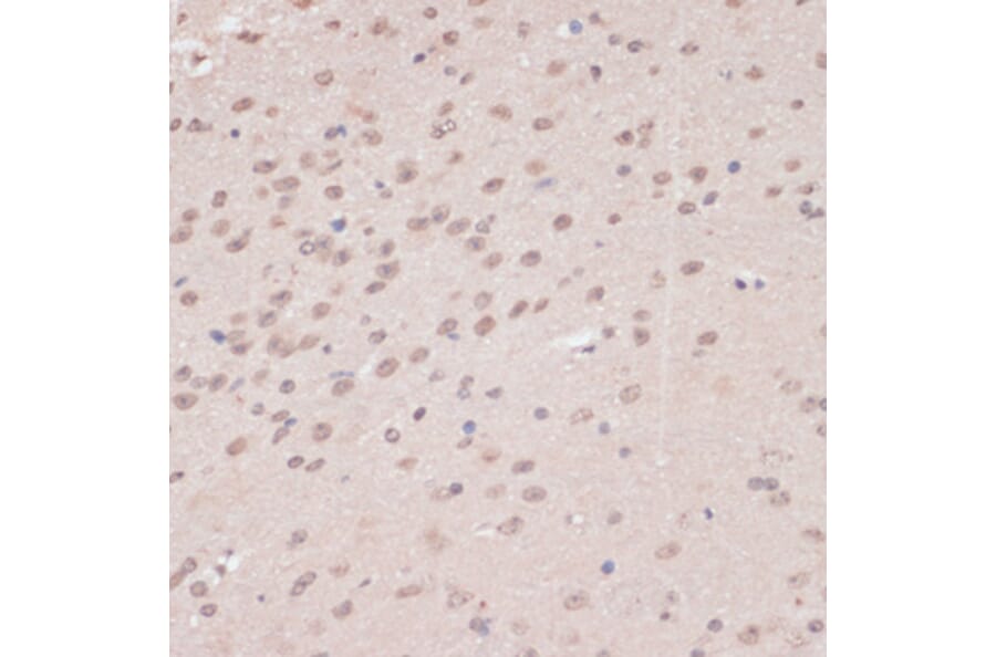 Immunohistochemistry - Anti-PRPF31 Antibody (A14938) - Antibodies.com