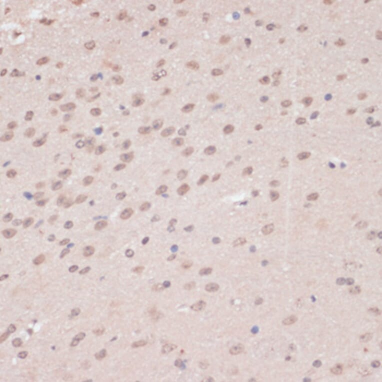 Immunohistochemistry - Anti-PRPF31 Antibody (A14938) - Antibodies.com