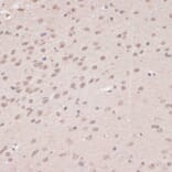 Immunohistochemistry - Anti-PRPF31 Antibody (A14938) - Antibodies.com