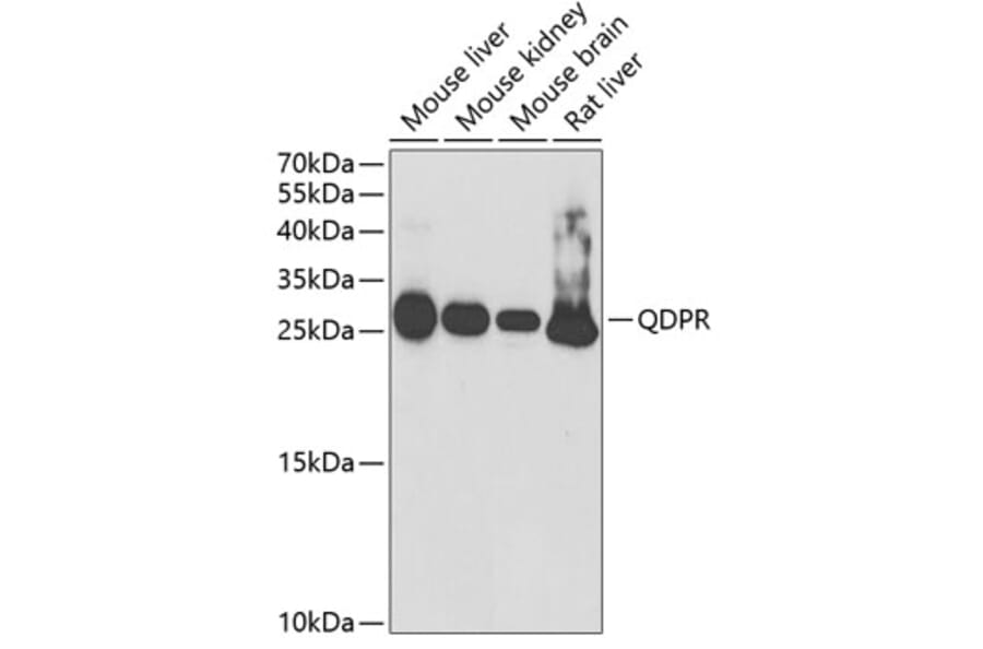 Western Blot - Anti-QDPR/DHPR Antibody (A14939) - Antibodies.com