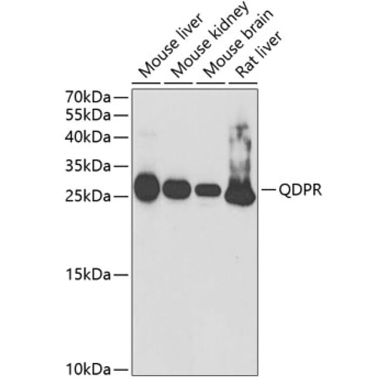 Western Blot - Anti-QDPR/DHPR Antibody (A14939) - Antibodies.com