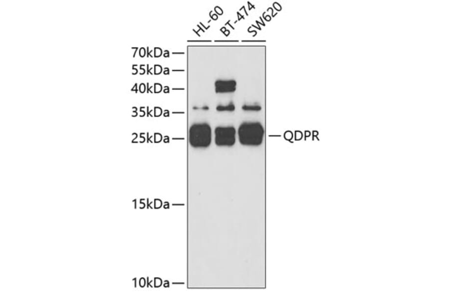 Western Blot - Anti-QDPR/DHPR Antibody (A14939) - Antibodies.com