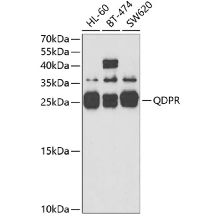 Western Blot - Anti-QDPR/DHPR Antibody (A14939) - Antibodies.com