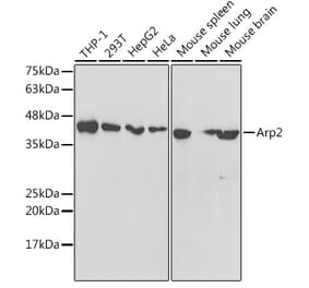 Western Blot - Anti-Arp2 Antibody (A14940) - Antibodies.com