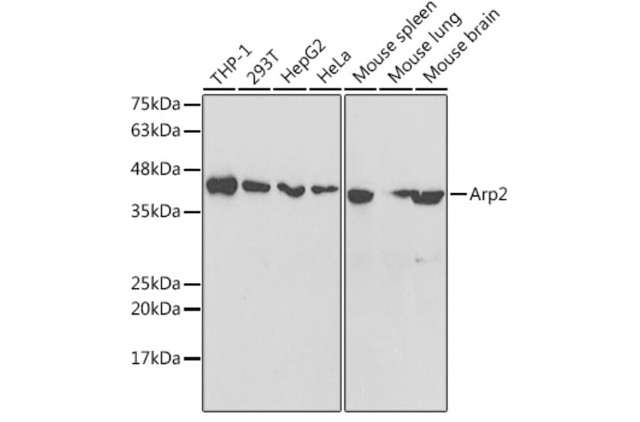 Western Blot - Anti-Arp2 Antibody (A14940) - Antibodies.com