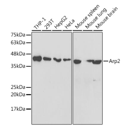 Western Blot - Anti-Arp2 Antibody (A14940) - Antibodies.com