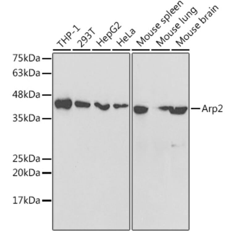 Western Blot - Anti-Arp2 Antibody (A14940) - Antibodies.com