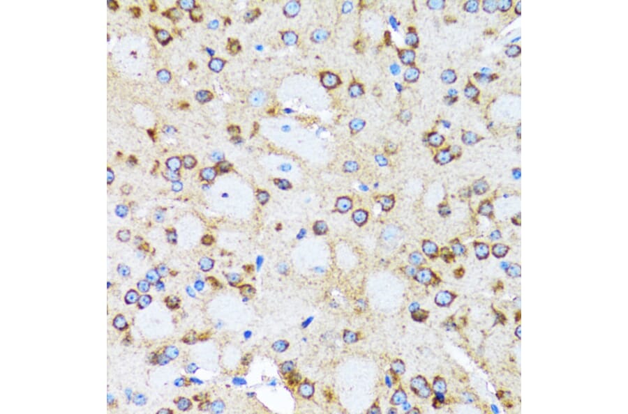 Immunohistochemistry - Anti-Arp2 Antibody (A14940) - Antibodies.com