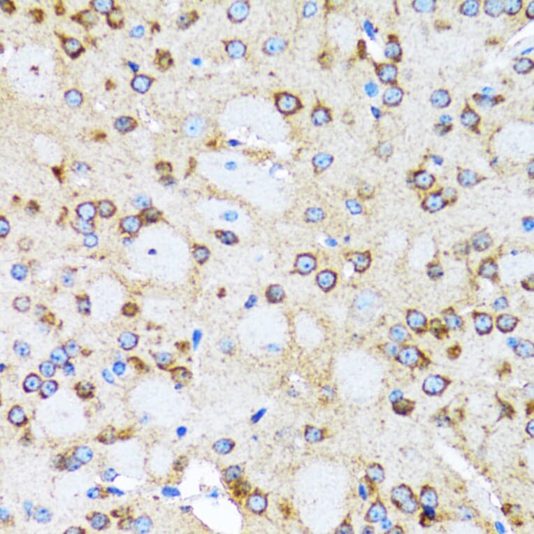 Immunohistochemistry - Anti-Arp2 Antibody (A14940) - Antibodies.com