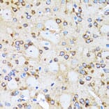 Immunohistochemistry - Anti-Arp2 Antibody (A14940) - Antibodies.com