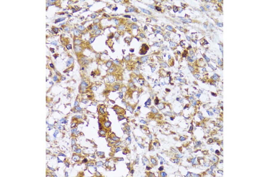 Immunohistochemistry - Anti-Arp2 Antibody (A14940) - Antibodies.com