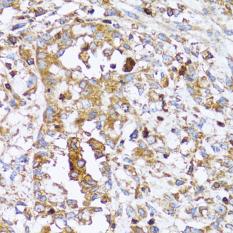 Immunohistochemistry - Anti-Arp2 Antibody (A14940) - Antibodies.com