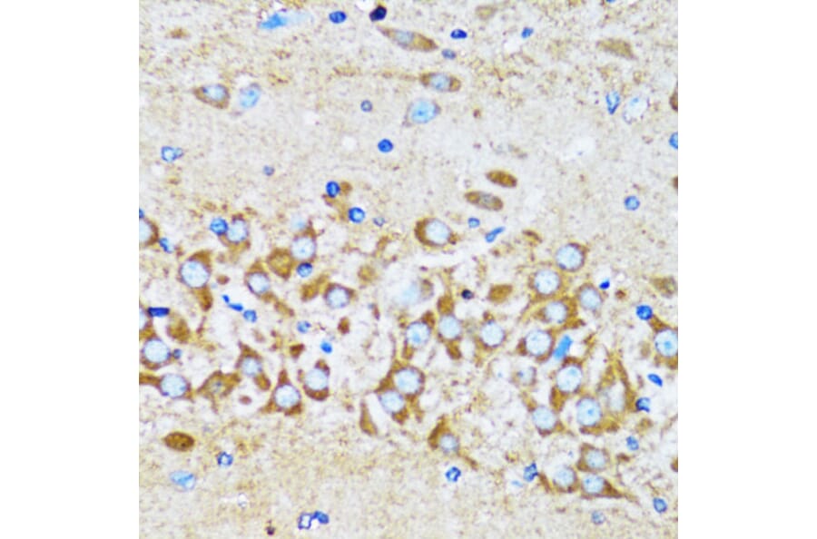 Immunohistochemistry - Anti-Arp2 Antibody (A14940) - Antibodies.com